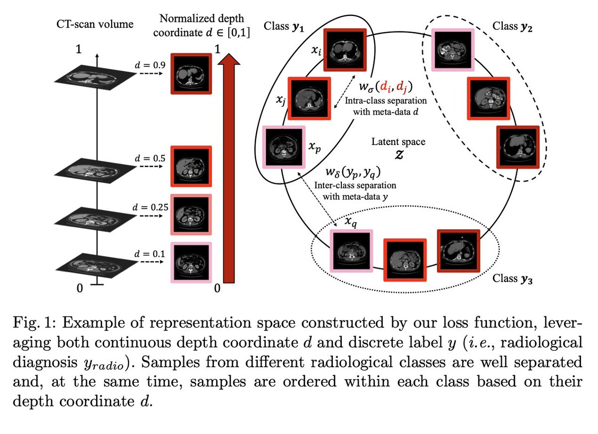 kornia_foss's tweet photo. Weakly-supervised positional contrastive learning: application to cirrhosis classification
@EmmaSarfati_, Alexandre Bône, Marc-Michel Rohé, Pietro Gori, Isabelle Bloch

tl;dr: use volumetric nature of medical images for learning. 
#kornia -> data aug.
https://t.co/0aEuMSUrpc https://t.co/hKhdExDfZG