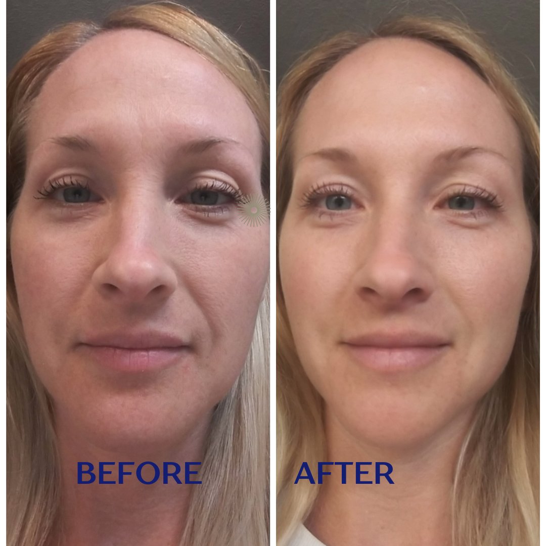 Activate_Evo's tweet photo. Thank you Jennifer for sharing this fabulous testimonial with us! BioQuantum Skincare results that everyone is raving about! #quantum #evolution #dna #dnaactivation #testimonial #testimonialtuesday #beforeandafter https://t.co/ZK40C9bkhL