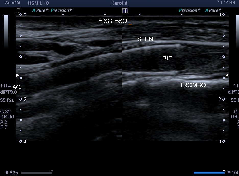 Neurosonology Lab - LHC tweet media