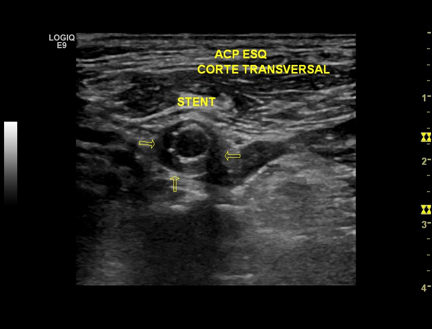 Neurosonology Lab - LHC tweet media
