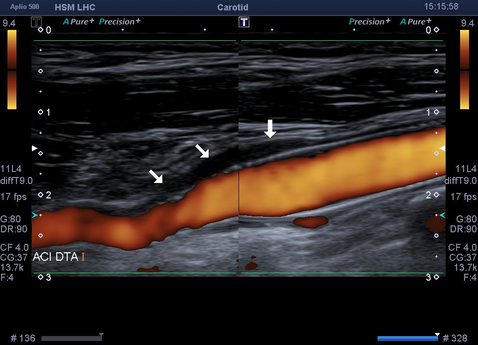 Neurosonology Lab - LHC tweet media