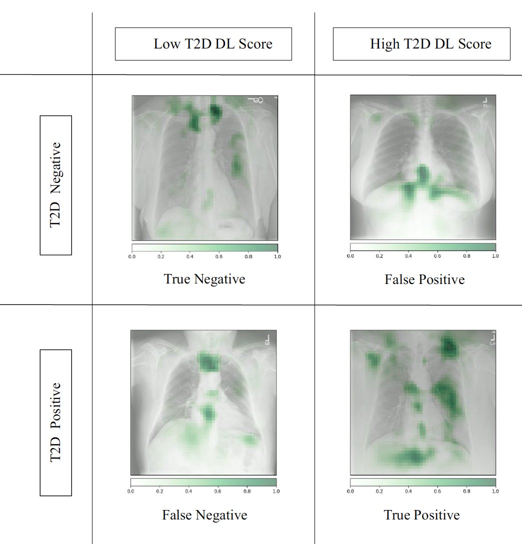 "Your Chest-ray indicates you may have diabetes"
nature.com/articles/s4146…
The latest unexpected outgrowth of deep learning #AI  
<a href="/NatureComms/">Nature Communications</a> <a href="/AyisPyrros/">Ayis Pyrros, MD</a> and colleagues