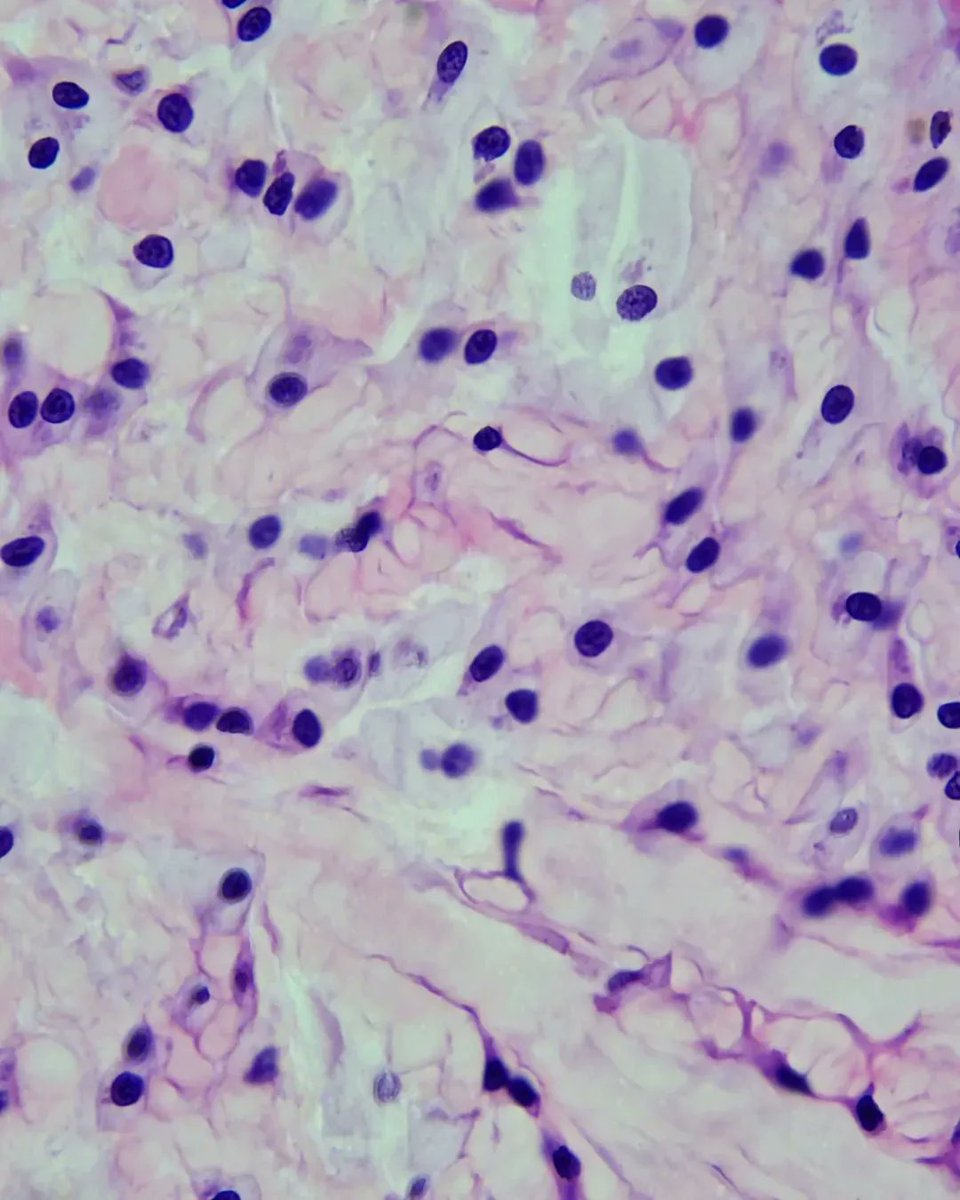 olkazuraw's tweet photo. This is a loose connective tissue that can be found e.g. in the umbilical cord.

Another beautiful pattern I found in my slide collection.

#Pathart #histologyart #microscopicphotography #microphoto #digitlart #nftart #Ilovehisto #ilovepathology https://t.co/IxPdEXt3ZW