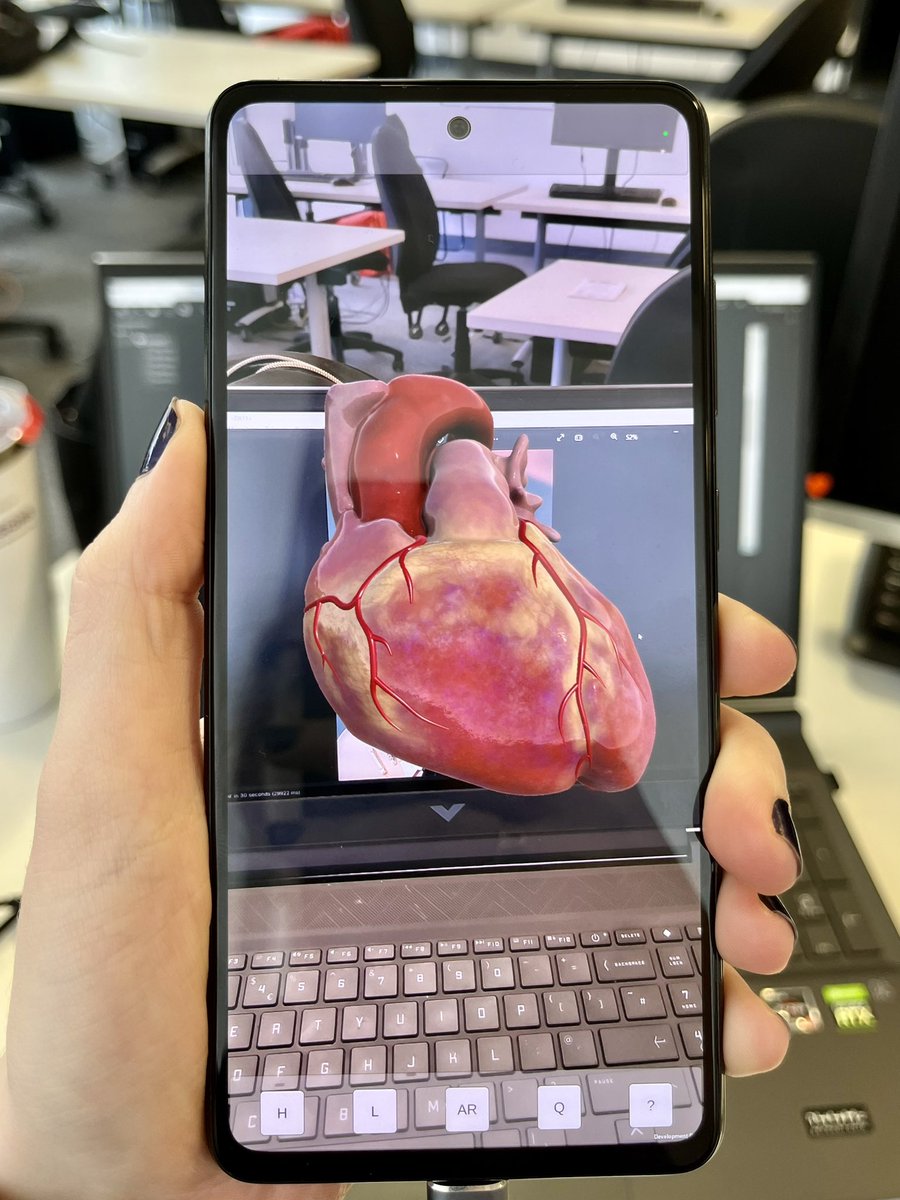 🫀Great shot of my app ‘ECG-in-AR’ progressing smoothly!

<a href="/GSofASimVis/">SIT-GSA</a>