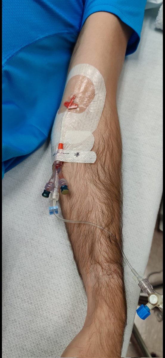 Brachial artery infusion of different transmitters/co transmitters to investigate mechanisms of hypertension. Fun! https://t.co/ousL7hoEVy