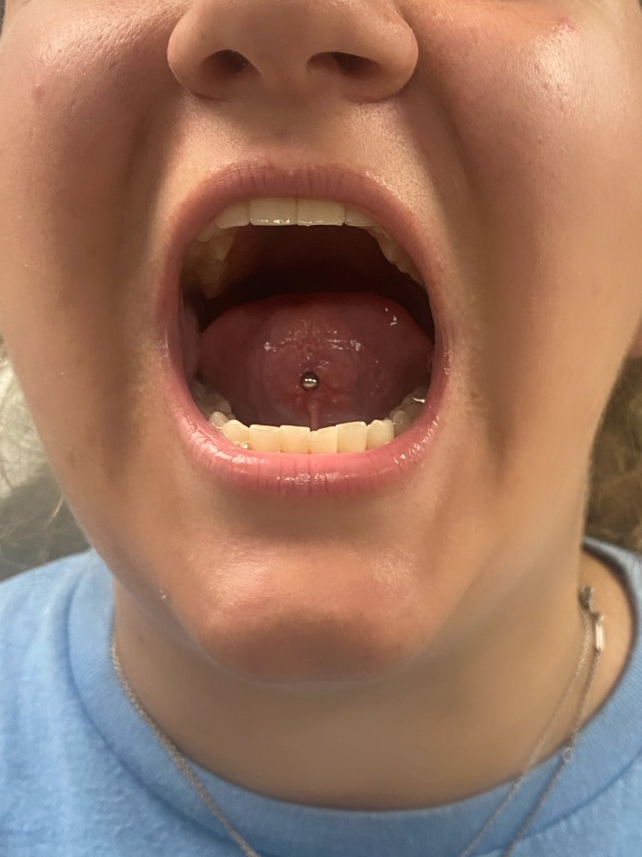 maggotxqueen's tweet photo. ⚔️Who’s Ready For Their Next Piercing? ⚔️
✨Come See Kris Today! ✨
#tonguepiercing #piercing #bodypiercer #bodymodification #inksinkershall #stabbed_bykris https://t.co/Pkv8NJNkld