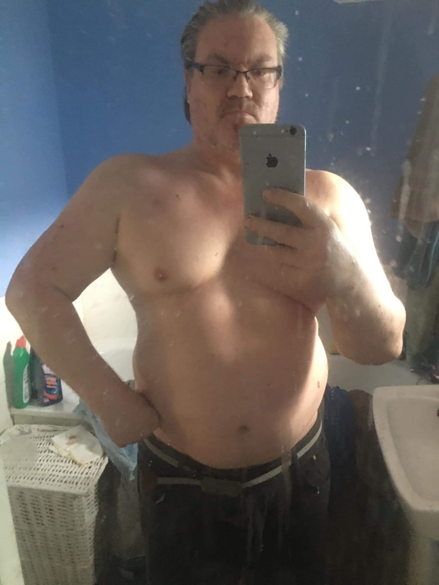 I SPENT A YEAR SLOWLY BECOMING OBESE....AT NEARLY 20 STONE....WHEN MY FIT MUSCULAR WEIGHT IS 19 STONE...BUT IVE BOUGHT A HOM WEIGHT SET AND BEEN TRAINING FOR 14 DAYS...AND JOINED...FITNESS FIRST GYM...SO MY TRANSFORMATION IS GOING WELL...AND MENTALLY I FEEL STABLE AND STRONG JC X