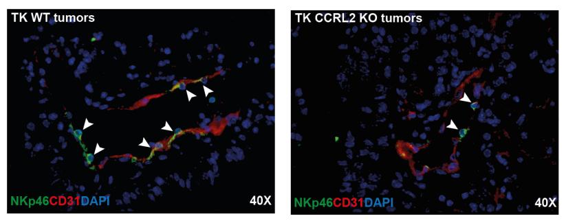 CIR_AACR's tweet photo. CCRL2 expression by specialized lung capillary endothelial cells controls #NKcell homing in #lungcancer, by Francesca Sozio, Tiziana Schioppa, Mattia Laffranchi, Annalisa Del Prete, Silvano Sozzani et al.
https://t.co/qu9C7vqyRP
@fbianchetto @raffaellabone @troppodifficile https://t.co/KPl7hrk4mS
