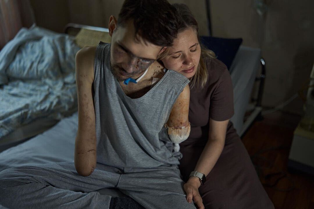 EuromaidanPress's tweet photo. A story of love, struggle and pain in photos by @Liberov 

Ukrainian warrior Andrii lost both arms, his eyes and partially his hearing in battle.

After fighting on the front, Andrii and his wife Alina continue their fight in a hospital ward. https://t.co/9vcrgqkpsc