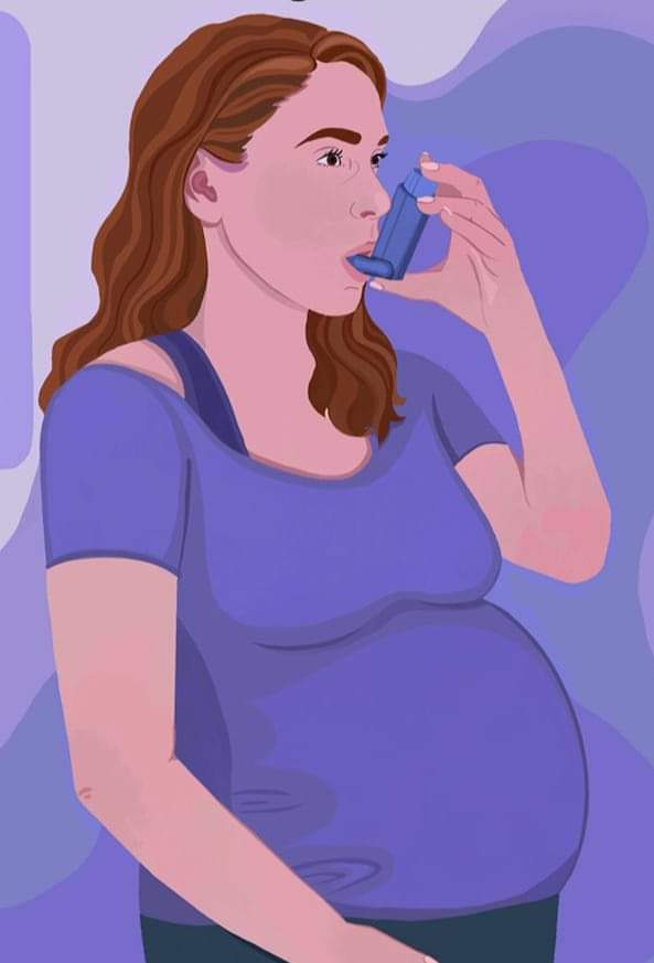 Ph_S_afwa_n's tweet photo. 🤰🏻لو عندنا امرأة حامل تعاني من نوبة ربو حادة (Acute Asthma Attack) ..  فهل الأفضل أن نستخدم لها بخاخ "Salbutamol" أو تبخيرة "Combivent" ؟؟

📚 الجواب: 

💠 أولا: لازم نعرف أن إنقاذ الحامل من الربو (على المدى القصير والطويل) هو الأولوية الكبرى .. 

لأن الربو خطير على الجنين (قد يعيق نمو الجنين أو يؤدي إلى تشويهه أو وفاته) ..

💠 ثانيا: من حيث الأمان على الجنين يبدو  أن البخاخ هو الخيار الأول لسببين: 

1️⃣ أن أمان بخاخ Salbutamol على الجنين موثق بشكل أكبر (بحسب التجارب على أجنة البشر) ..

2️⃣ أن كمية الدواء التي تصل إلى الجنين من "البخاخ" أقل من الكمية التي تصل له من "التبخيرة" ... خصوصا إذا تم استخدام "البخاخ" مع spacer ..

🌟🌟 ملاحظة 🌟🌟

إذا كانت الحامل لا تجيد استخدام البخاخ (و هذا أمر شائع جدا) .. أو أن البخاخ لم ينفعها في علاج نوبة الربو الحادة 👈👈👈 فلا شك في أنه يمكننا استعمال التبخيرة المذكورة والتي تتكون من: 
Salbutamol & ipratropium.

🌹Thank you 🌹

🌷 لمتابعة كل جديد في علم الأدوية 🌷 : 

#منقول
من صفحة الدكتور 
#د_وليد_السباخي 
#Pharmacology
#Ph_S_afwa_n 

🌼يمكنكم  متابعة جديد الدكتور عبر حساباته الرسمية في مواقع التواصل الإجتماعي التالية:🌼

🌟Telegram Channel:
https://t.co/eJb3oqQmWC 

💊Official Facebook Page: 
https://t.co/eRSykpenV9 

💊 Official Youtube Channel:
https://t.co/b14C1nMiC6
