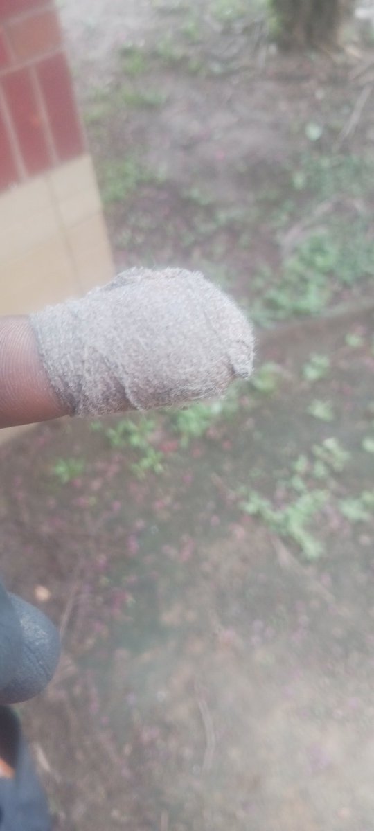 PD3s1gn's tweet image. Today started off crumb asf fuck damn nearly took the tip of my left hand FU finger off at work...wrap that bitch up and kept working....I once told I have a high high tolerance4pain...today I learned my worth...to pain shit higher than the mega lottery haven't throbbed all day