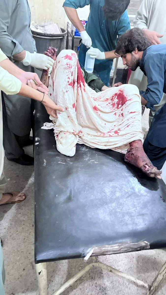 Ajmal_K_Kakar's tweet photo. ایف سی بھگاو
بلوچستان بچاو
چوکیدار سے خطرے میں رہنے والے بلوچسان کے باسیوں اس غلام نظام کو دیکھا دینا ہوگا
ایف سی کی مارٹر گولہ لگنے سے ژوب کاکڑ ٹاون کے 2رہاٸشی شدید زخمی
تاحال فاٸرنگ کی سلسلہ جاری ہیں
#ZhobUnderAttack
#SaveZhob https://t.co/DBcHz3ZyUm