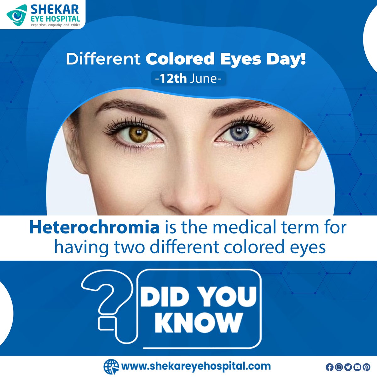 Unleash the magic of heterochromia on Differently Coloured Eyes Day. 

our website at shekareyehospital.com.

#ShekarEyeHospital #DifferentColoredEyesDay #Heterochromia #DifferentColoredEyes #BeautifulEyes #UniqueEyes #RareEyes #SpecialEyes #Oneofakindnd #RareBeauty