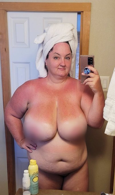 I was vigilant with sunscreen. I was WHITE with it!  But this is Tx. It was 103 today. 🤷&zwj;♀️  We're all