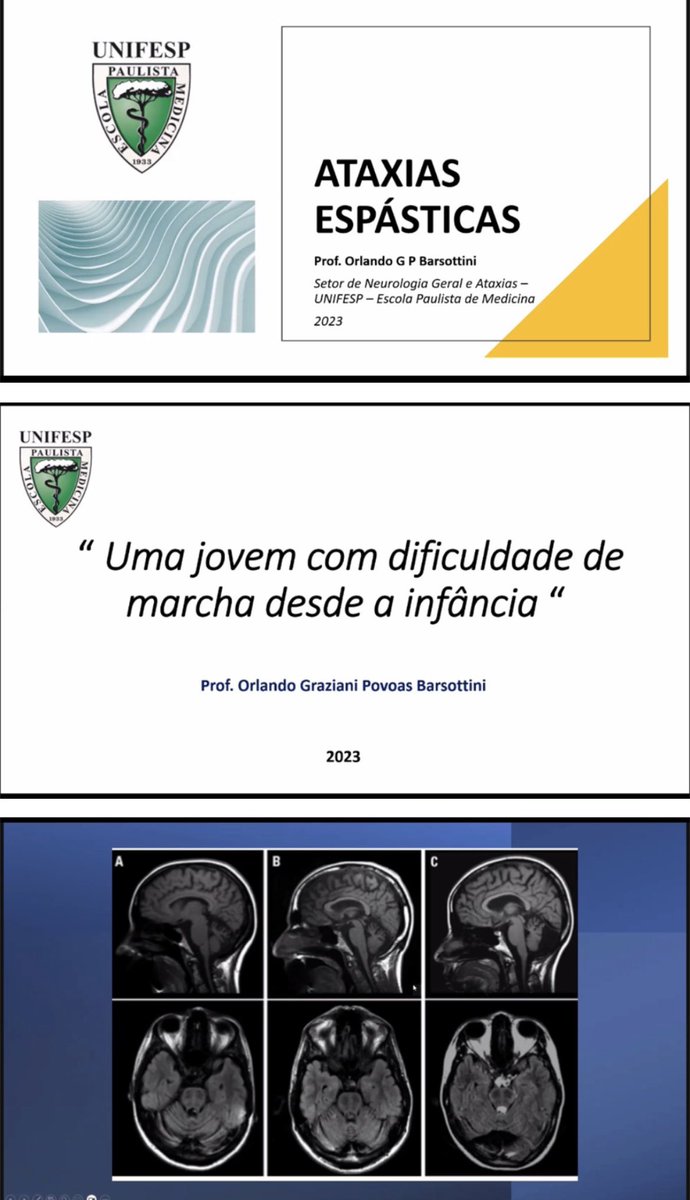 Flávia de Paiva Rolim (@flavianeuro) on Twitter photo Great session today at our monthly scientific meeting of @cemovpi, featuring Prof. Orlando Barsottini discussing spastic ataxias. Our virtual meetings on Zoom are an excellent way to stay connected and learn together.
<a href="/DeniseCury4/">DeniseCury</a> <a href="/Janinelobolopes/">Janine Lobo Lopes, MD</a> <a href="/macordellini/">Macordellini</a> Great session today at our monthly scientific meeting of @cemovpi, featuring Prof. Orlando Barsottini discussing spastic ataxias. Our virtual meetings on Zoom are an excellent way to stay connected and learn together.
<a href="/DeniseCury4/">DeniseCury</a> <a href="/Janinelobolopes/">Janine Lobo Lopes, MD</a> <a href="/macordellini/">Macordellini</a>