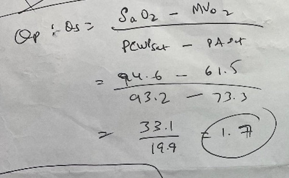 Umair2017's tweet photo. 8/ Finally, we got wedge / PCWP sat (93%), PA sat (73%) and Arterial Sat (94.6%) to calculate Qp:Qs = 1.7
Given Qp:Qs 1.7, patient with RA/RV enlargement, and exertional dyspnea, we referred the patient for surgical correction for #PAPVR https://t.co/ub1nK0z6uH