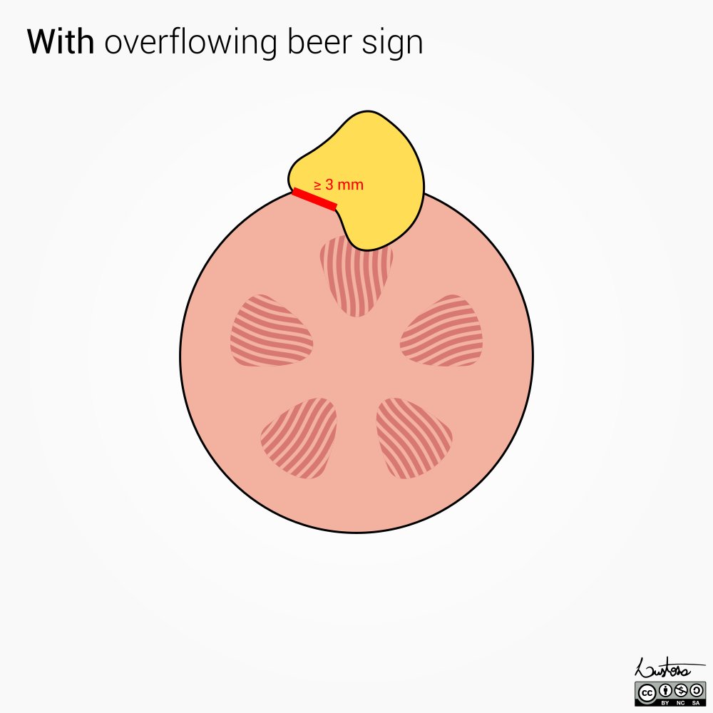 DrLeoLustosa's tweet photo. 🍺 Overflowing beer sign

Illustrations made for the renal imaging workshop on #Radiopaedia2023

Thanks for the invitation to draw these @DrVikasShah and @JosephMullineux 

They were really fun to make 🍻 https://t.co/xkvcK8GJqt