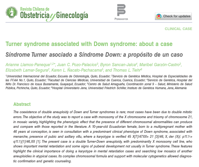 UIDE's tweet photo. #InvestigacionUIDE 🔎 | Conoce un caso de coexistencia de síndromes de Down y Turner en una misma paciente, algo que se da 1 en cada 2.000.000 de nacimientos, la combinación de estas dos anomalías es lo que se analiza en este artículo, revísalo completo en https://t.co/rAkbZETqkm https://t.co/gHmd7WSxjO
