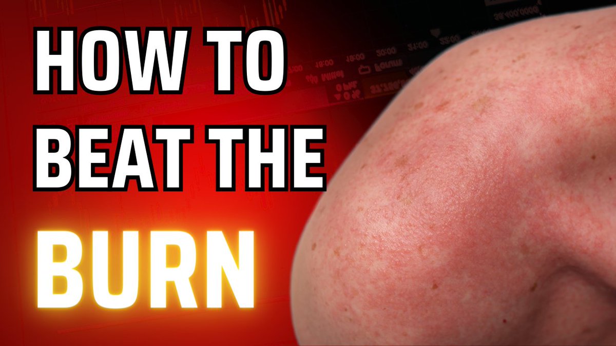 Beat the Burn: Discover 9 Home Remedies For Heat Rash! #heatrash #heatrashremedy #heatrashrelief

youtube.com/watch?v=UUJ5fU…