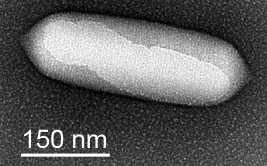 mikhailshapiro's tweet photo. What's the bloody mechanism behind the ultrasound contrast dynamics of #gasvesicles in circulation?
Congrats to @bill_ling and collaborators at @Caltech and @TheChanLab on finding out! 
https://t.co/hHqWMEP8R2 https://t.co/FNyR2vGU4X