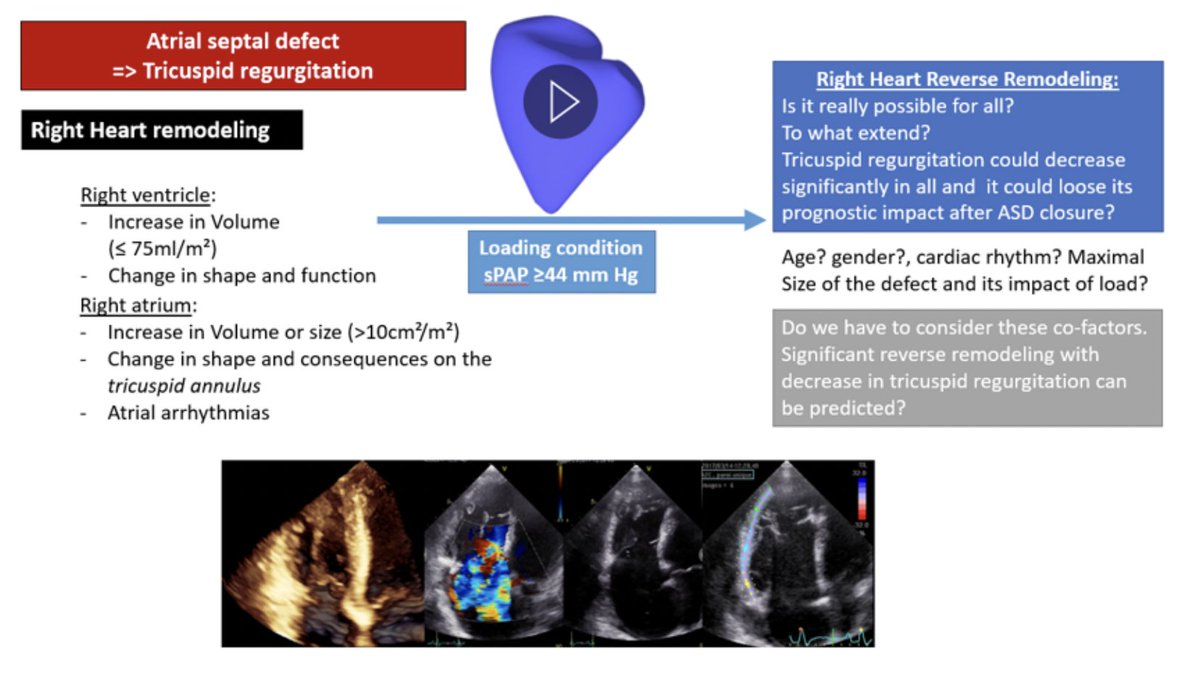 Do not underestimate the impact of load and of remodelling capabilities of the right heart ❤️ bit.ly/3TpdPXl