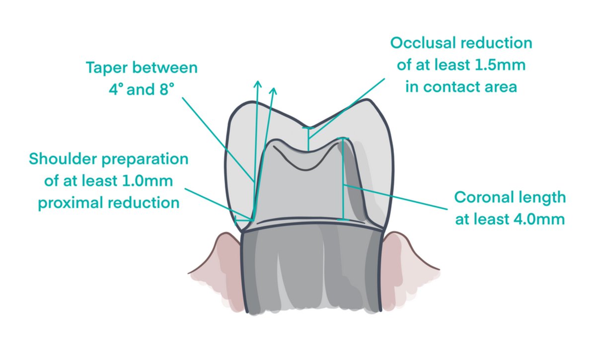 ddldental's tweet photo. When prepping a case, prepare the unit(s) for the best digital restoration possible under the circumstances.

https://t.co/EqLEy4Kyz2

#digitaldentistry https://t.co/fjvrQnUOQA