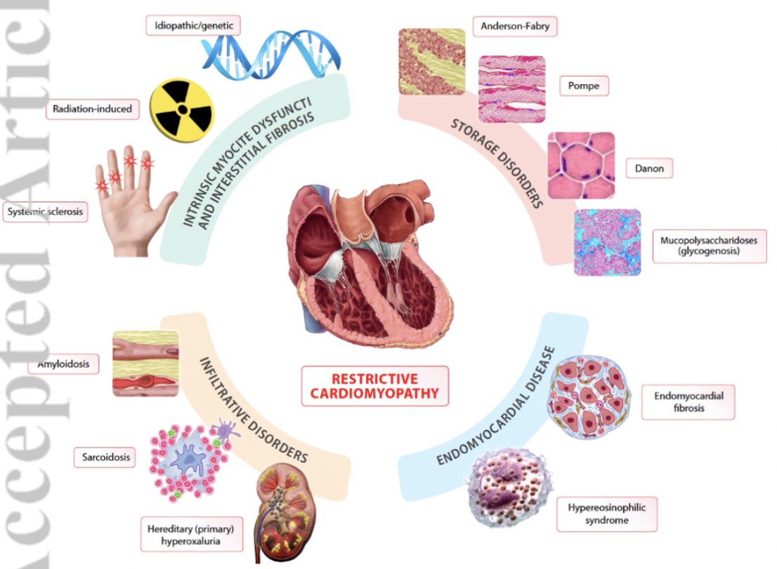 📌#StateOfTheArt 📝 on optimal contemporary management of #cardiomyopathies 

#CardioTwitter #CardioEd #Review #HCM #DCM #RCM