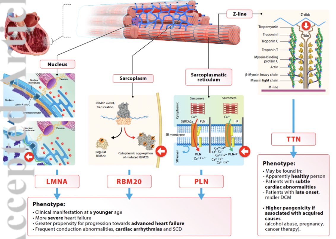 SeguraCardio's tweet photo. 📌#StateOfTheArt 📝 on optimal contemporary management of #cardiomyopathies 

#CardioTwitter #CardioEd #Review #HCM #DCM #RCM https://t.co/t5Na3gpux4