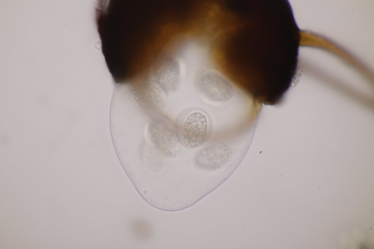 RPilze's tweet photo. Podosphaera amelanchieris ex Amelanchier lamarkii
#Amelanchierlamarkii #Amelanchier #KupferFelsenbirne #juneberry #guillomo #Podosphaeraamelanchieris #Podosphaera #Powderymildew #EchterMehltau #fungus #Pilz #Phytopathology #nature #natur https://t.co/feTgljczKo