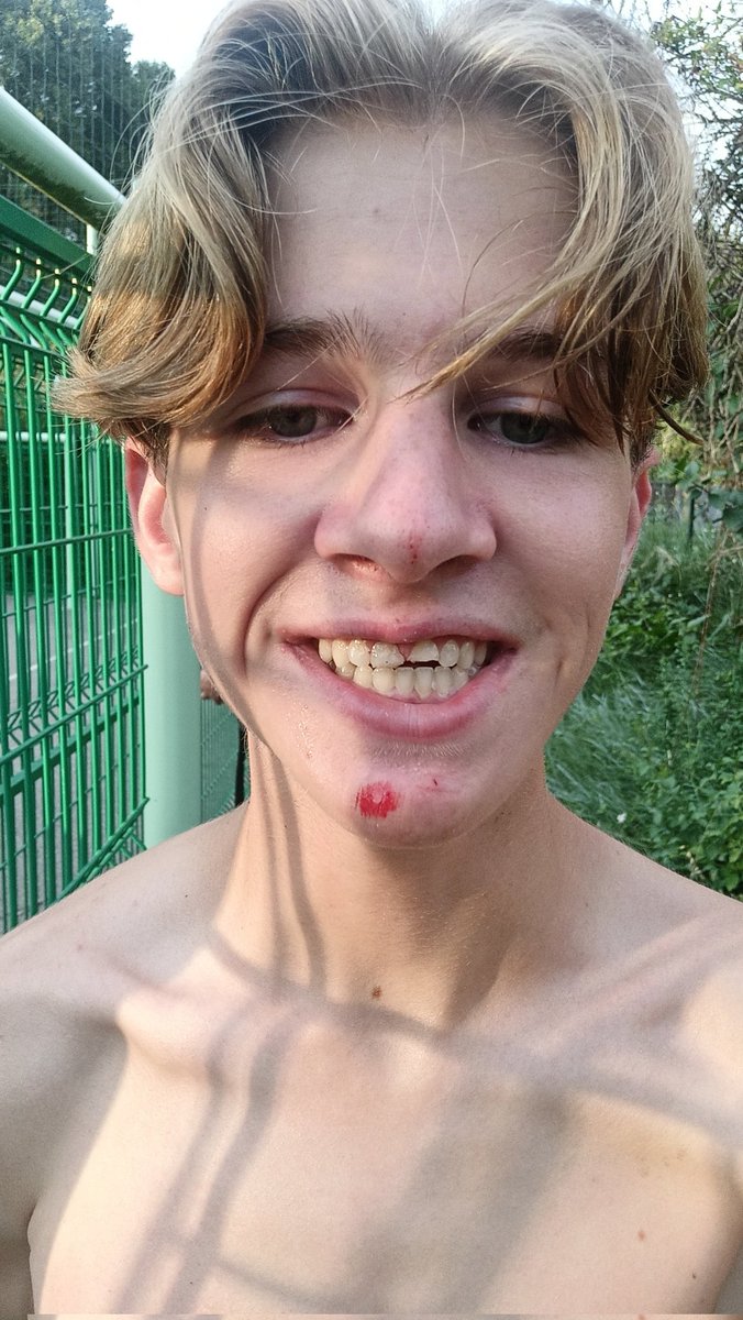 Singerie ☄️ tweet media