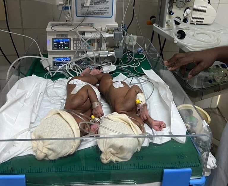 UCAD_Senegal's tweet photo. Félicitations à toute l’équipe du CHU de la Mère &amp; de l’Enfant Tchad pour cet exploit! 
Ils ont réussi la sépar de 2 jumelles siamoises
Une première qui marque une avancée dans le domaine de la médecine
#ucad est fière de voir ces alumnis briller de par le 🌏
#kebetu #compublique https://t.co/E0Z3OMZZky