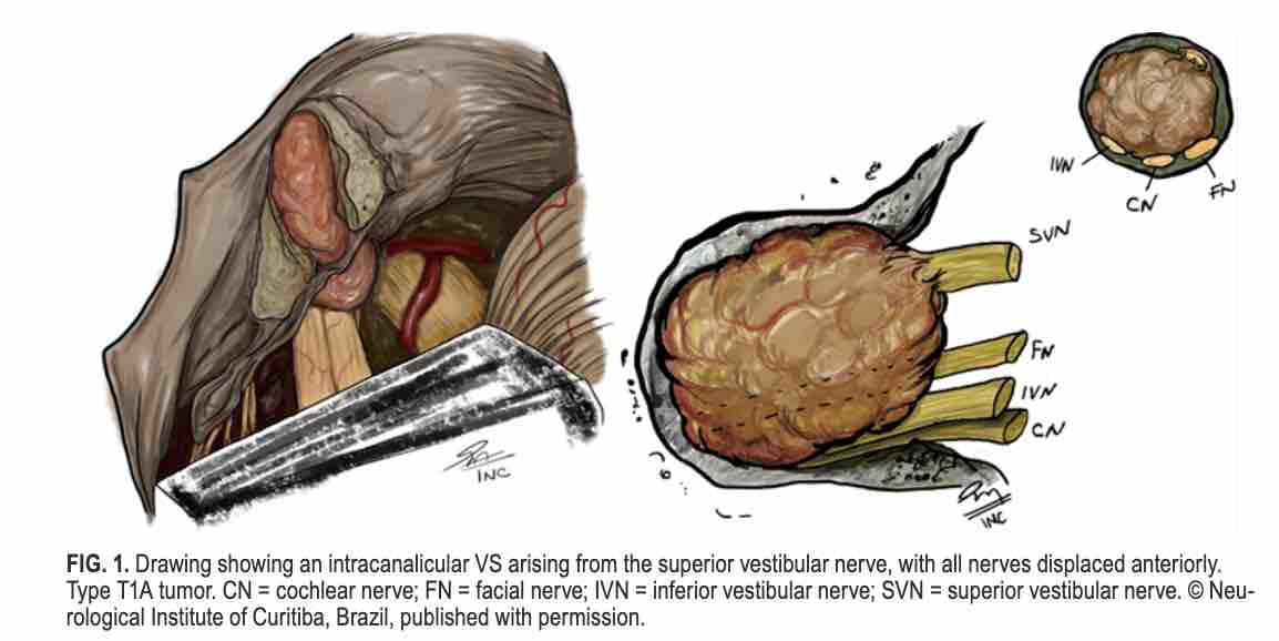 Journal of Neurosurgery tweet media