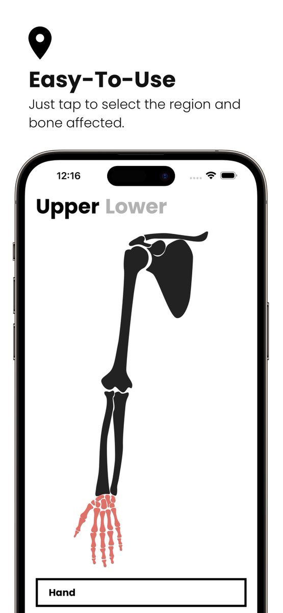thame's tweet photo. I'm excited to share that https://t.co/4sdLXzkUkG is available today free for iOS and Android devices!

Just tap the bone and fracture pattern and get instant recommendations on immobilization options, instructions for splint application and important management pearls. https://t.co/06O3Ew09Xe
