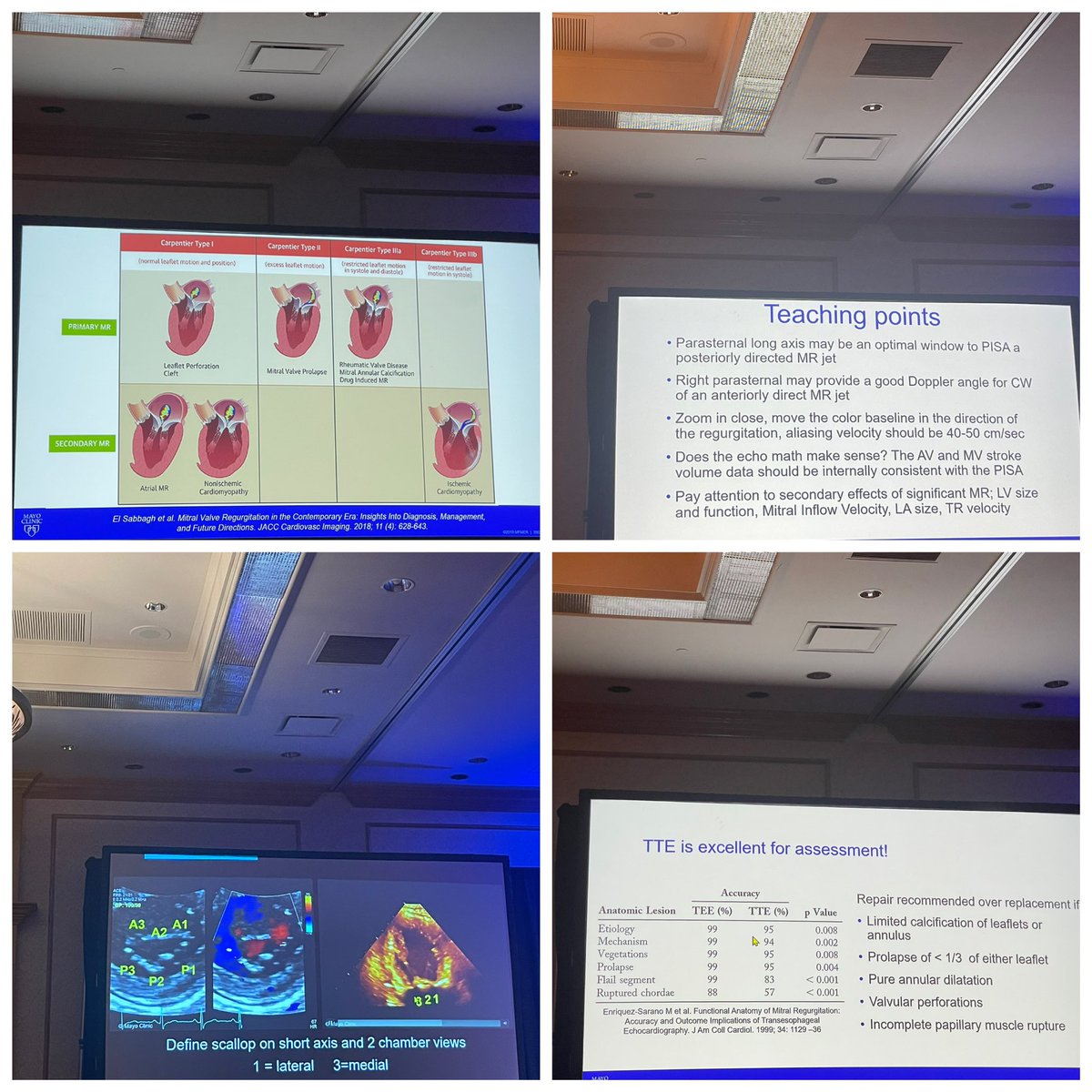 Kicking off the 2nd Mayo Echo-Alaska meeting with great mitral regurgitation cases and echo imaging Pearls @MayoClinicCV @Grace_Lin_MD @roeckler @RMankadMD