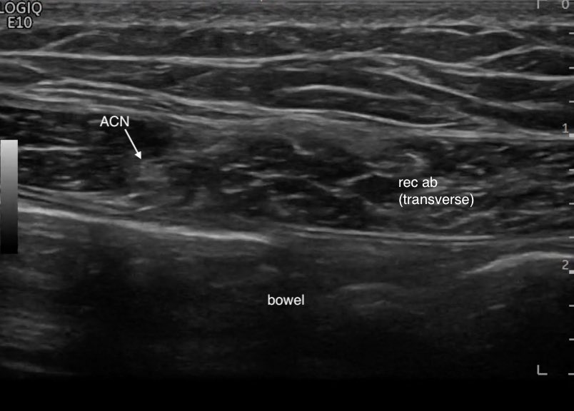 James Noake tweet media