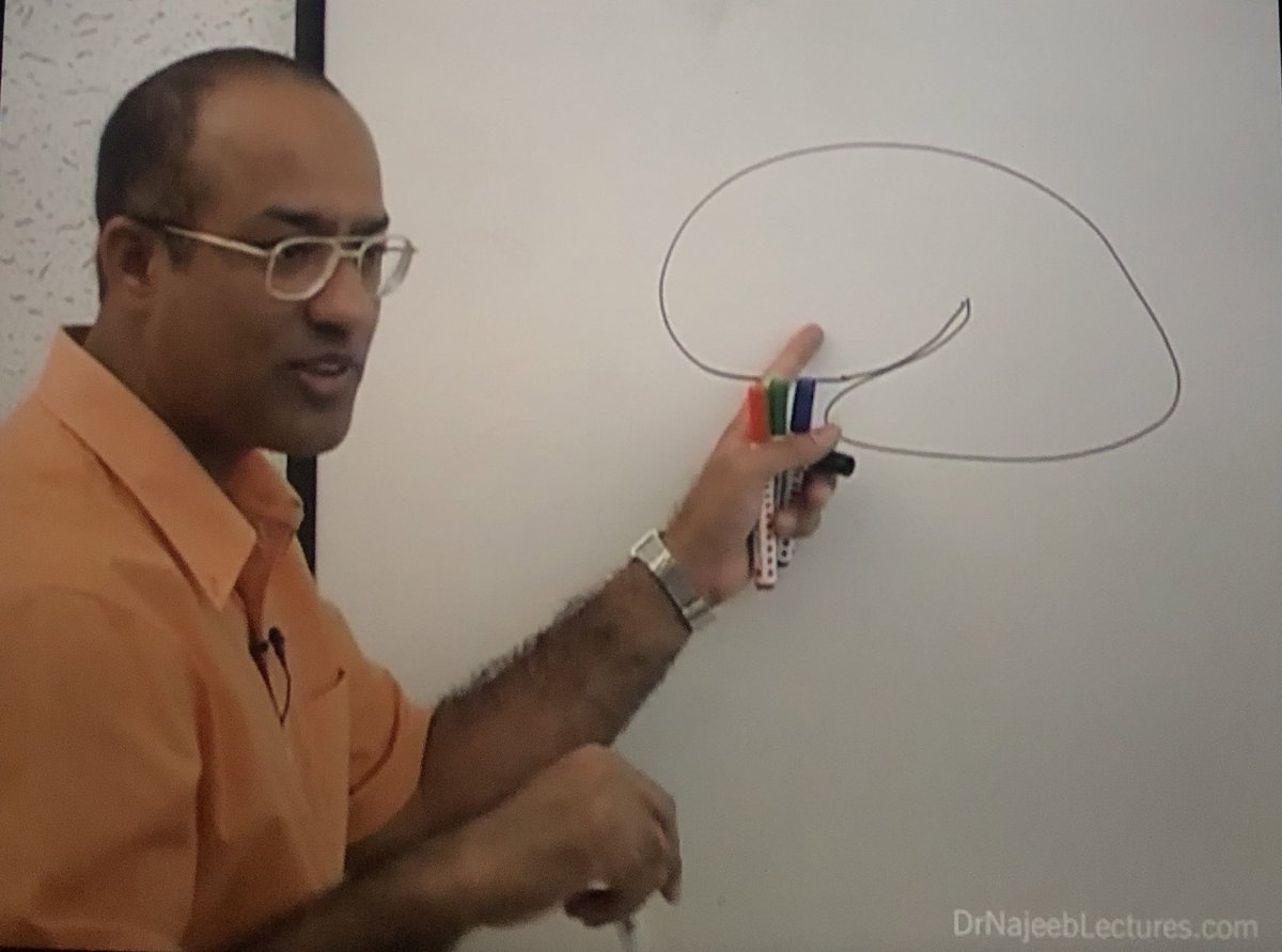 WashijaB's tweet photo. Dr najeeb: what is this?
Me: brain
Dr najeeb: superolateral side of cerebral hemishpere 
Me: oh 🤡 https://t.co/3l5USjIctW