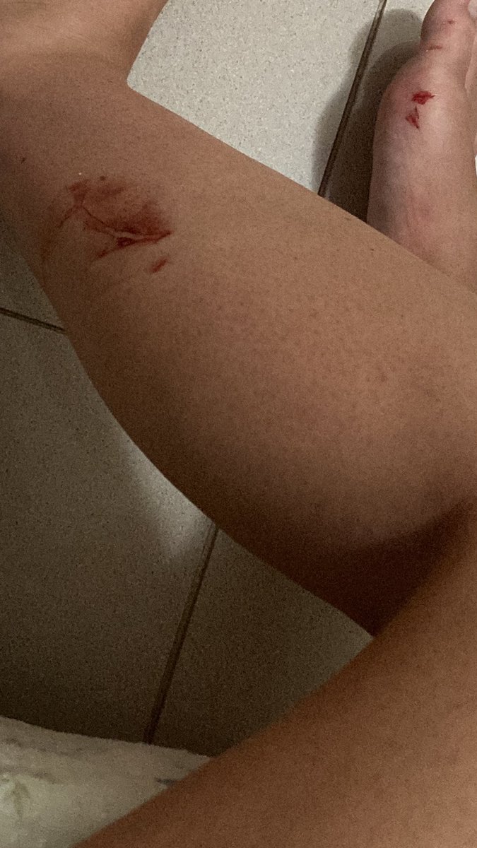 talonsss's tweet photo. Oggi primo salvataggio. Mi sono fatta a momento più male io che il signore https://t.co/Fxirg2MViF