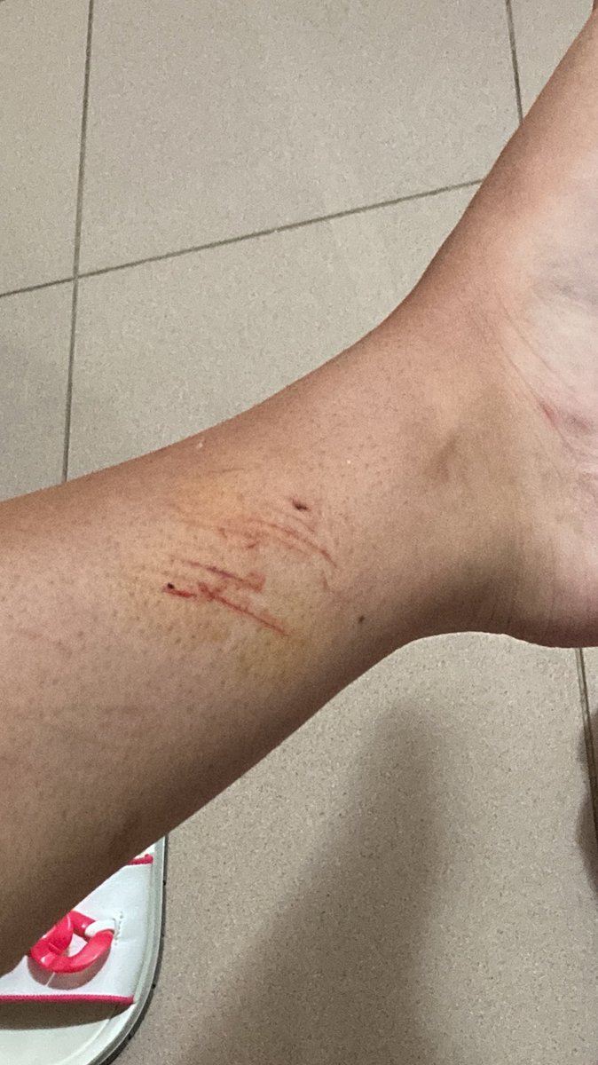 talonsss's tweet photo. Oggi primo salvataggio. Mi sono fatta a momento più male io che il signore https://t.co/Fxirg2MViF