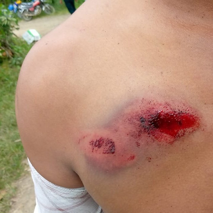 FNAntiminero's tweet photo. 🔴 #URGENTE 
Hasta el momento se registran cinco campesinos heridos en Sigchos por una violenta represión policial y militar auspiciada por la transnacional canadiense Ático Mining. "Por favor ayúdenos, no están solo con balas de gomas, nos están disparando".

@CorteConstEcu https://t.co/JJPKLvrKux