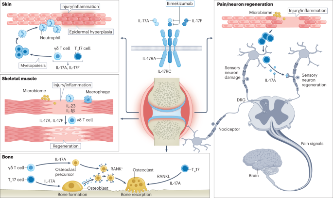 NatRevRheumatol's tweet photo. New content online! IL-17A and IL-17F in tissue homeostasis, inflammation and regeneration https://t.co/WWoxWF3hew https://t.co/870JYzJemC