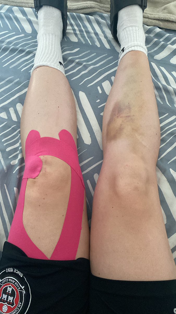 4 days later suspected PCL tear. Better than what I thought it might be. The result of 3 games in 6 days! <a href="/EasternWFL/">Eastern Womens Football League</a>