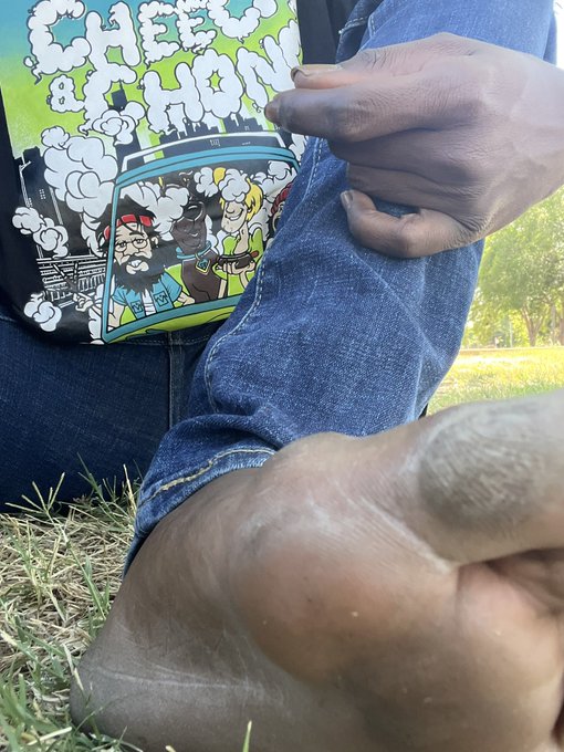 My 👣 feet are so ugly🐸, but who cares? I do foot content, so hit me up! Any fellow fans of #uglyfeet<a href="/tag/uglyfeet"class="tags"><span>#uglyfeet</span></a>