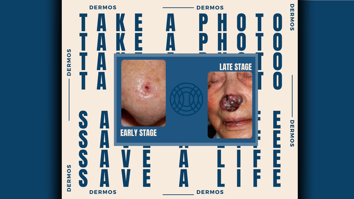Dermos_com's tweet photo. Don't wait for a skin spot to change color, texture, size or shape. Download our Dermos™ app (link in bio) take a picture of you or a loved ones concerning skin spot(s) &amp; get skin answers back quickly!

Our goal is to help save lives &amp; catch skin cancer in the early stages!
#ai https://t.co/sV92qiY4CM