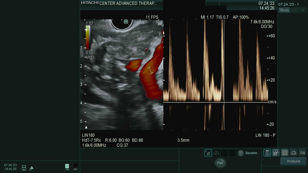 Douglas G. Adler MD, FASGE, FACG, AGAF tweet media