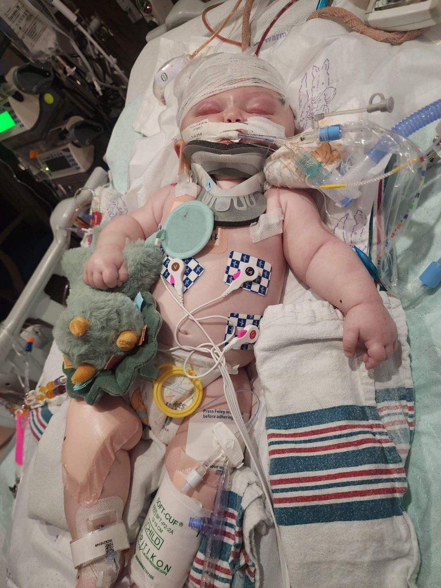 HER EYES ARE OPEN AND SHE'S RESPONDING TO SOUND: Korra defies the odds at Oklahoma Children's Hospital. Ponca City Police say the baby suffered severe head trauma in the hands of her babysitter. Tonight at 6 <a href="/News9/">News 9</a> - her milestones and what's next.

news9.com/story/64bb2047…