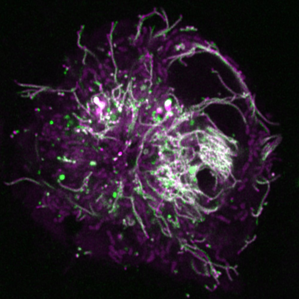 Here is our new paper that identifies a role for LRRK2 in suppressing the degradative activity of lysosomes and macrophages and microglia. pnas.org/doi/epdf/10.10…