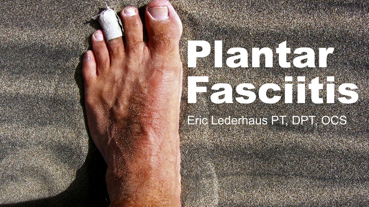 arc_running's tweet photo. Are you experiencing plantar fasciitis issues? Join our physical therapist in a FREE 30-minute virtual workshop as he discusses the causes and rehabilitation principles of plantar fasciitis. 

Learn more and register at https://t.co/RElodvqeQ6 https://t.co/bg06vQHafM