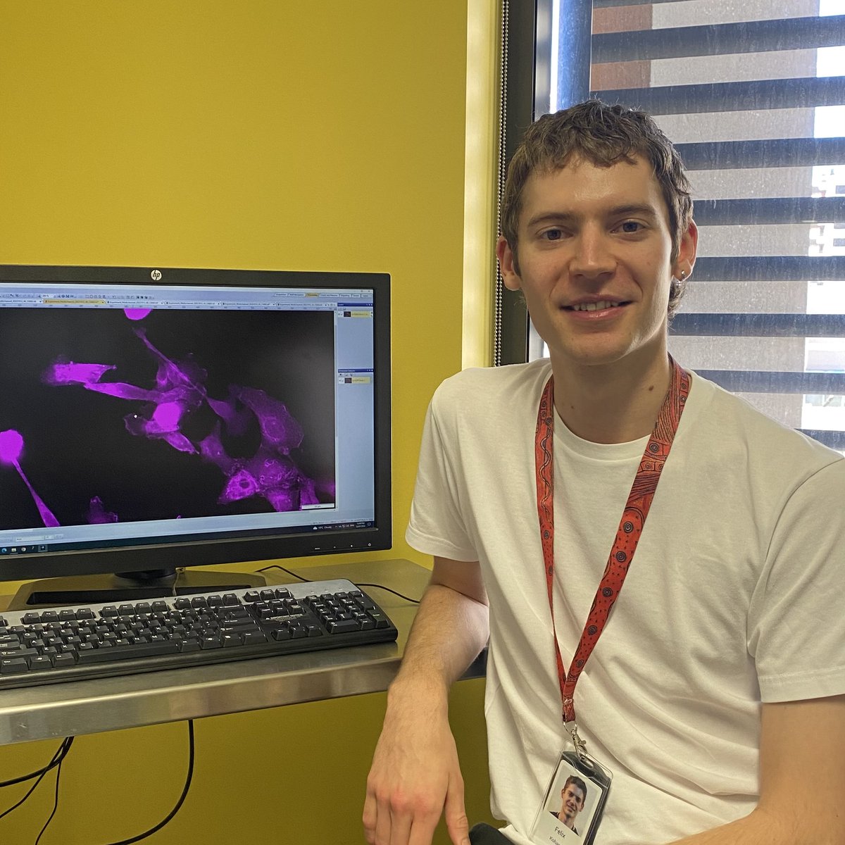 "A typical day during my PhD involves a bike ride through Centennial Park on the way into the lab. Once there, I make sure my cell cultures are happy and healthy before focussing on either planning, conducting, or analysing my experiments."
