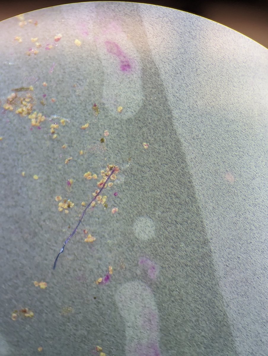 McNeishAqEcoLab's tweet photo. Anthropogenic #microfibers in stormwater samples! https://t.co/fTh245pzAT