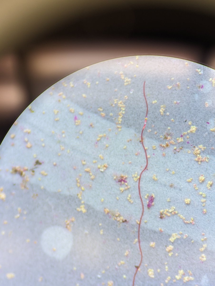 McNeishAqEcoLab's tweet photo. Anthropogenic #microfibers in stormwater samples! https://t.co/fTh245pzAT
